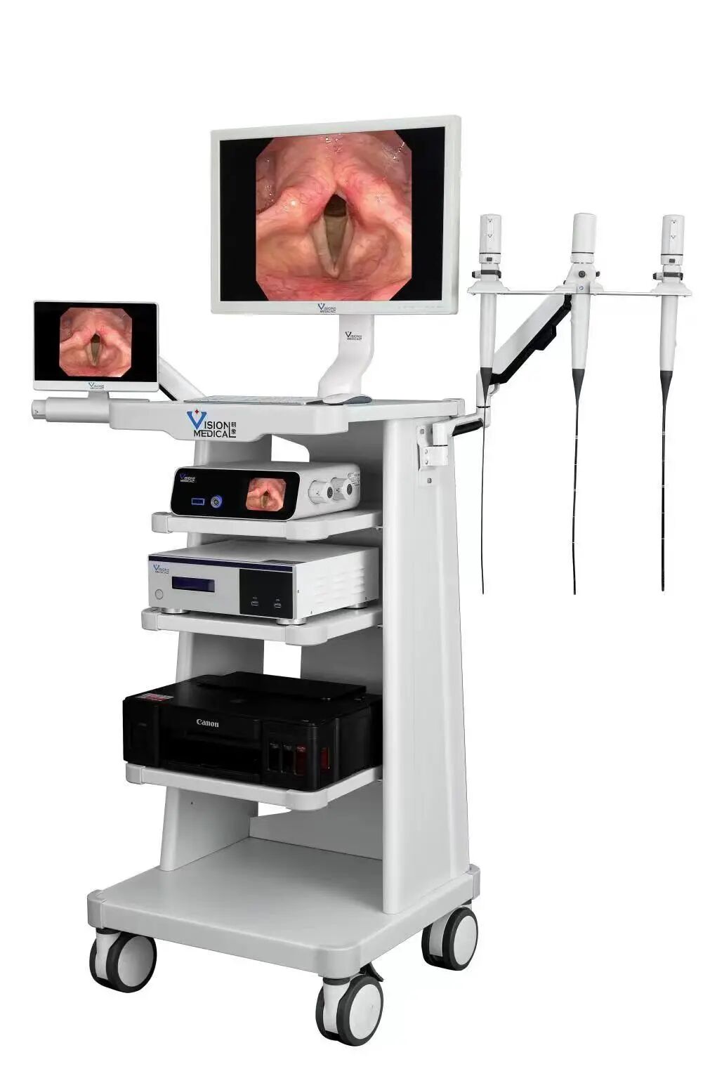 什么是电子鼻咽镜我院五官科引进高清鼻内窥镜摄像系统及电子喉镜_https://www.jmylbn.com_新闻资讯_第3张