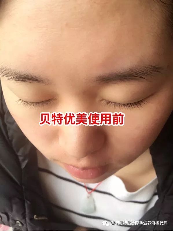 贝特优美睫毛增长液效果怎么样 如何代理 怎么辨别真假 小贝睫毛增长液大区总代招代理 微信公众号文章阅读 Wemp