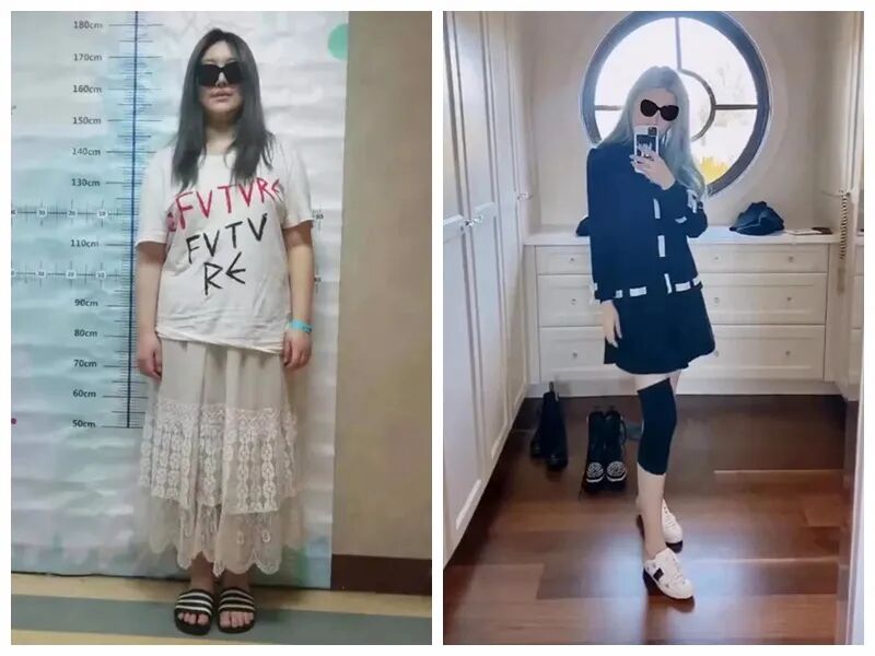 减肥手术有哪些方法_减肥手术多少钱_手术减肥