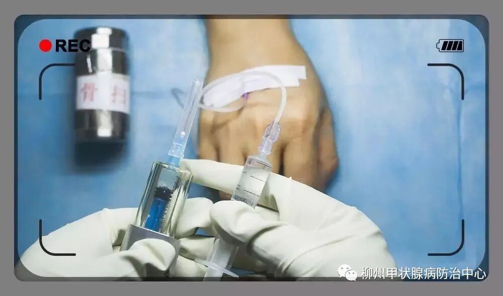 d-spect怎么检查SPECT／CT 检查需要注意什么？看看这里，告诉您这样做~_https://www.jmylbn.com_新闻资讯_第14张