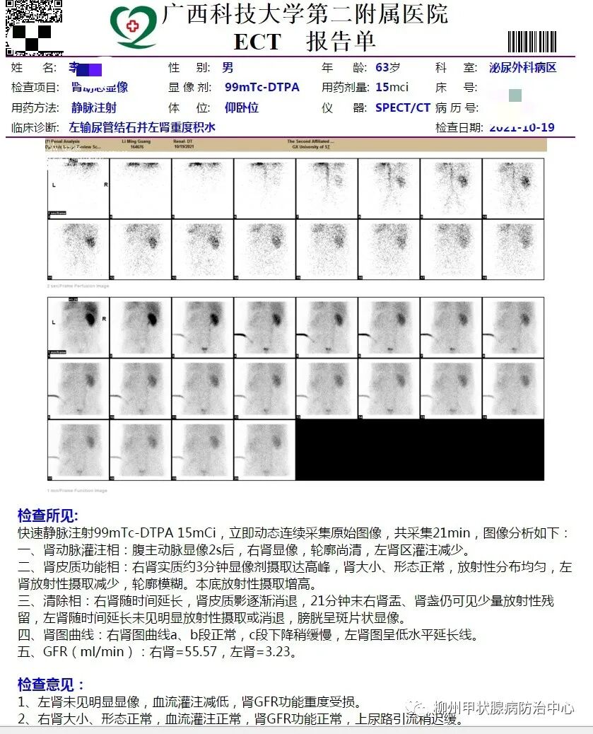 d-spect怎么检查SPECT／CT 检查需要注意什么？看看这里，告诉您这样做~_https://www.jmylbn.com_新闻资讯_第4张