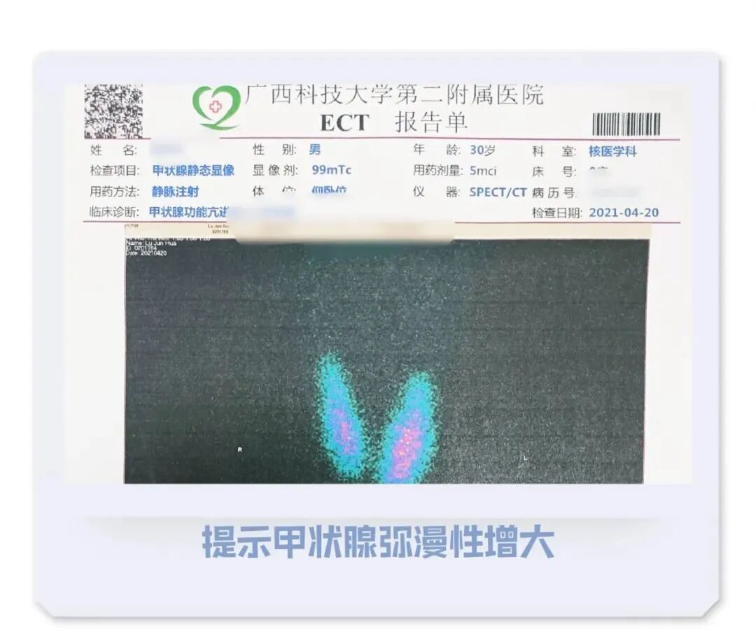 d-spect怎么检查SPECT／CT 检查需要注意什么？看看这里，告诉您这样做~_https://www.jmylbn.com_新闻资讯_第3张
