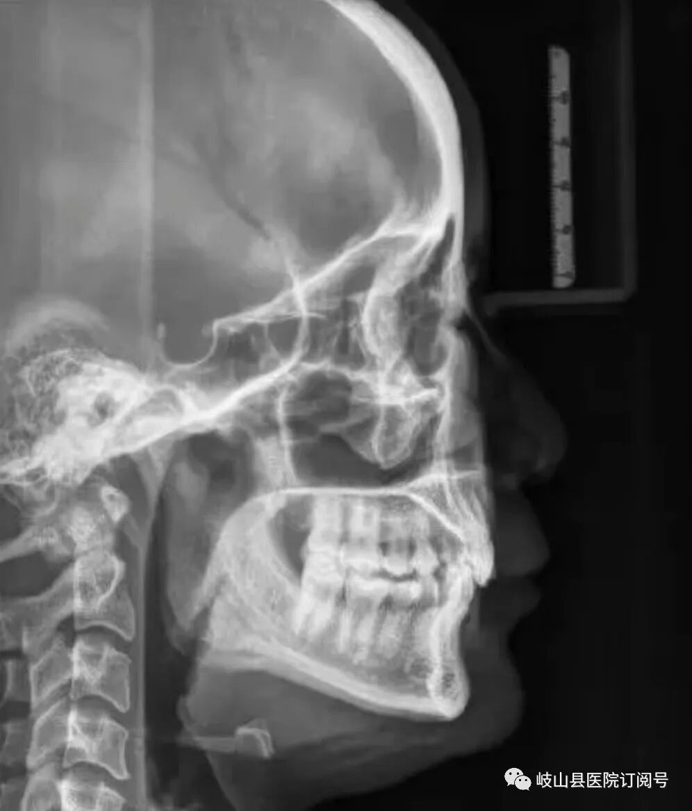 数字牙片机怎么用县医院口腔科引进卡瓦X-TREND口腔三合一CBCT现代化数字检查设备_https://www.jmylbn.com_新闻资讯_第18张