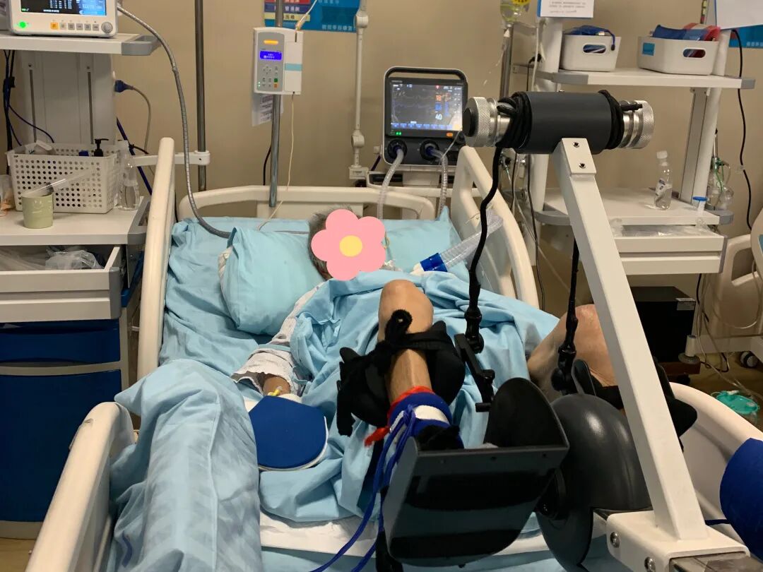 重症icu患者正在做床旁功率自行车康复训练