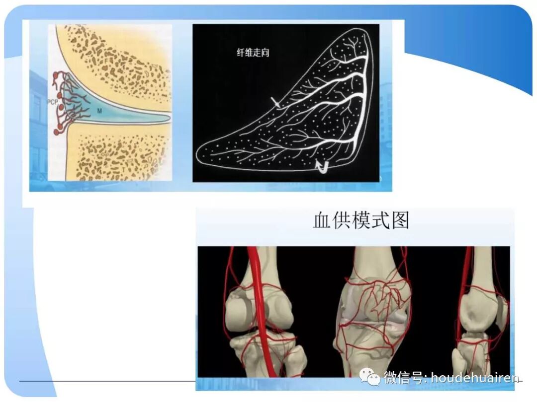 膝关节半月板损伤的诊断与治疗