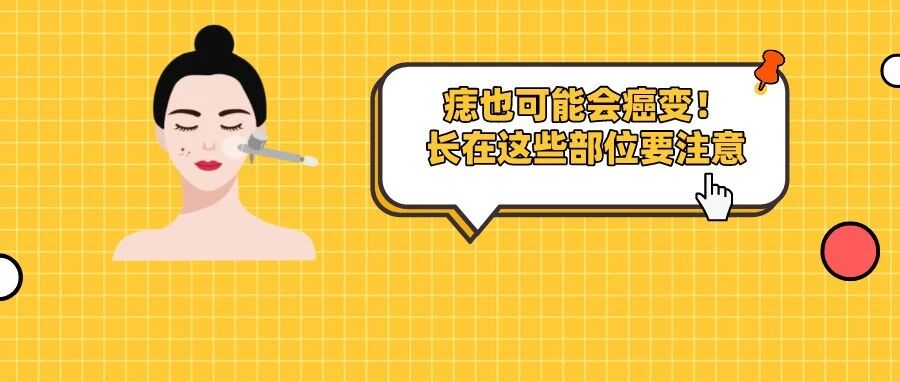 痣也可能会癌变！长在这些部位要注意