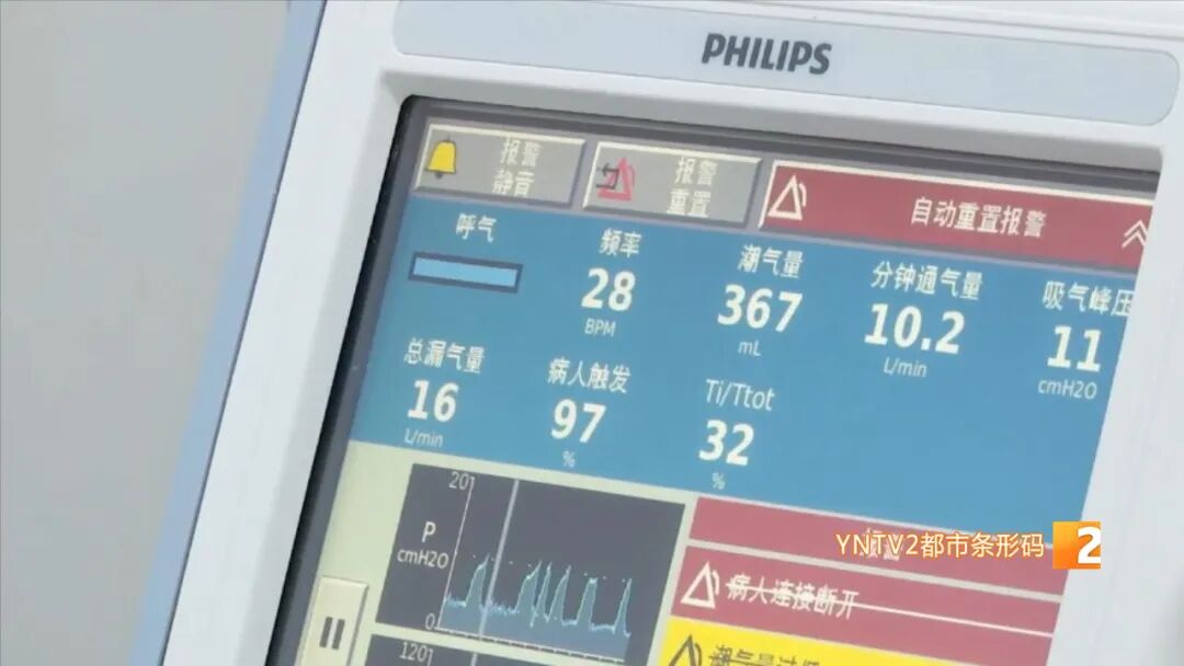 家用制氧机注意什么血氧仪制氧机热销！购买要注意什么？是否为家庭必备？_https://www.jmylbn.com_新闻资讯_第16张