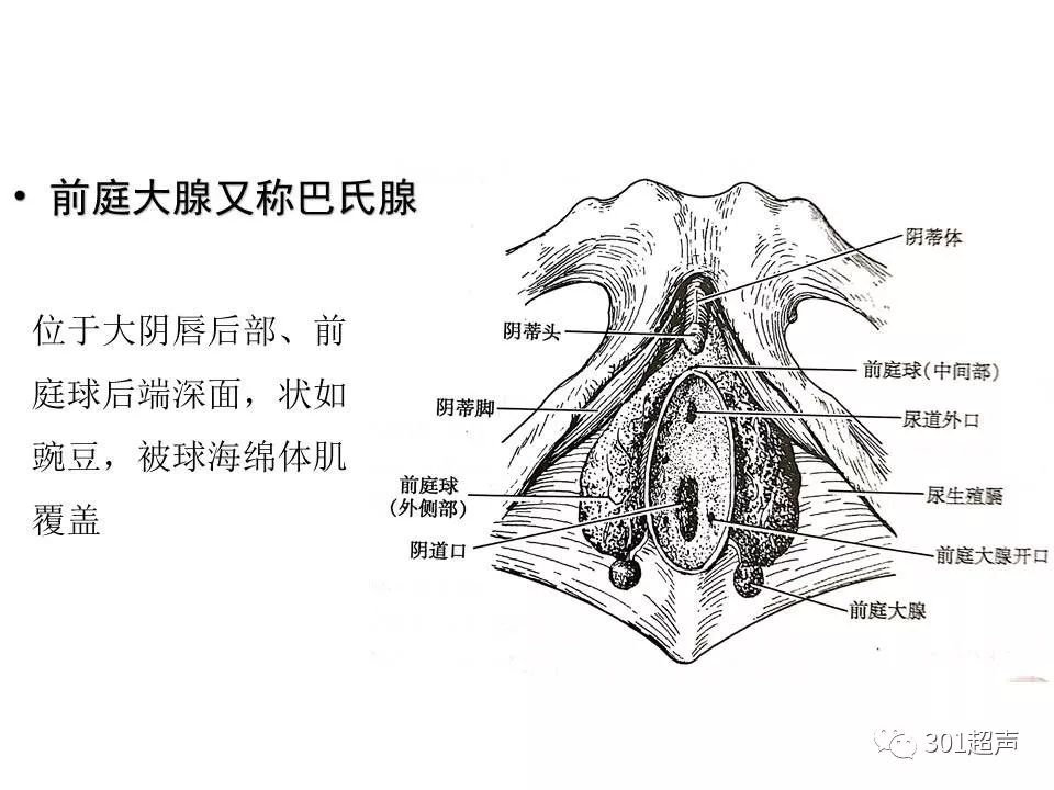 前庭大腺囊肿 301超声 微信公众号文章阅读 Wemp