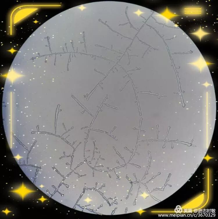 显微镜下鲜花开 喜迎欢乐中国年 检验医学网 微信公众号文章阅读 Wemp