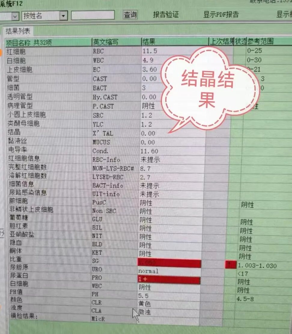 尿沉渣仪器怎么使用“你是谁”？被尿沉渣仪器错过的神秘结晶_https://www.jmylbn.com_新闻资讯_第2张