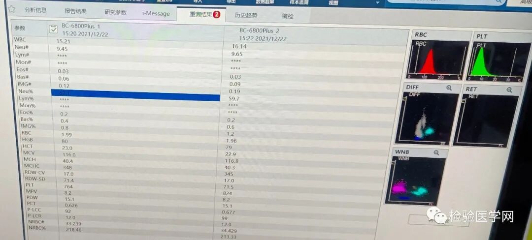 血常规用什么仪器检查同厂家仪器两次血常规结果相差巨大，原因值得所有检验人警惕！_https://www.jmylbn.com_新闻资讯_第2张