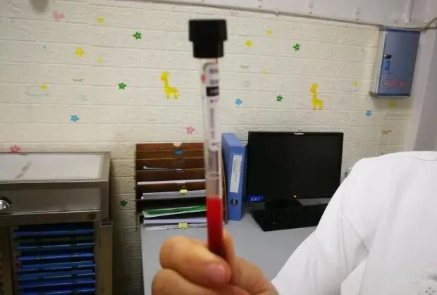 什么叫真空采血针标准明确！静脉采血时，究竟是先拔针还是先拔真空管？_https://www.jmylbn.com_新闻资讯_第4张