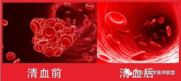 高压臭氧治疗什么HOT高剂量臭氧＂（三氧）＂自血免疫激活疗法_https://www.jmylbn.com_新闻资讯_第6张