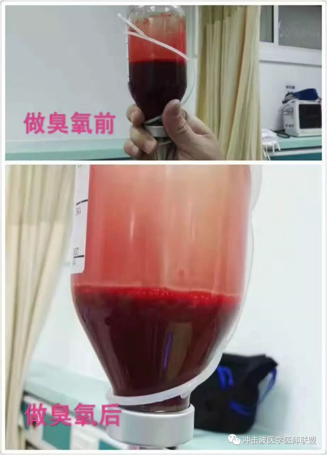 高压臭氧治疗什么HOT高剂量臭氧＂（三氧）＂自血免疫激活疗法_https://www.jmylbn.com_新闻资讯_第7张