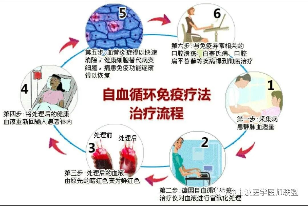 三氧疗法怎么代理预防脑出血@试试三氧自体血免疫疗法！_https://www.jmylbn.com_新闻资讯_第7张