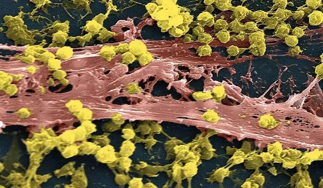 发现，尤其是因为革兰氏阴性菌经常对抗生素和其他抗菌干预产生抗药性。