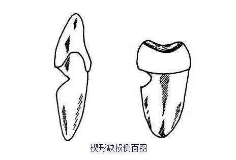 愚人节丨口腔防愚攻略你get到了吗