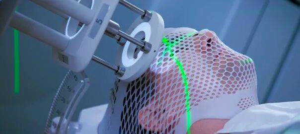 医用射线有哪些这就是放射治疗常用的3类射线！ ｜ 放疗常识第7期_https://www.jmylbn.com_新闻资讯_第2张