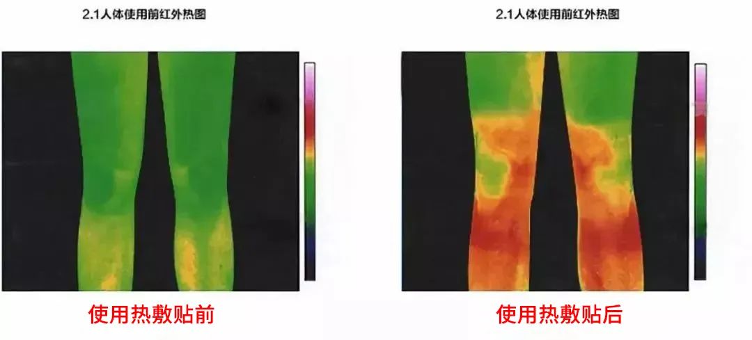 理疗热敷贴怎么贴这个东西是老寒腿克星！每天坚持能让腿脚年轻20岁！_https://www.jmylbn.com_新闻资讯_第16张