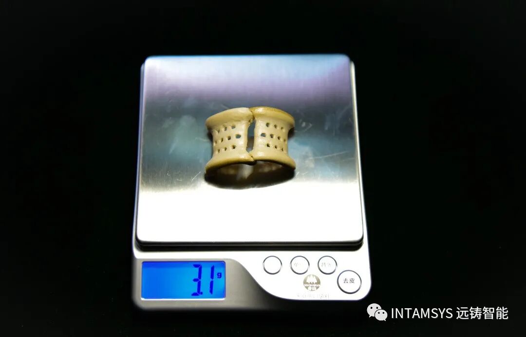 唐都醫(yī)院：3D打印PEEK植入體治療胡桃?jiàn)A綜合征的圖2