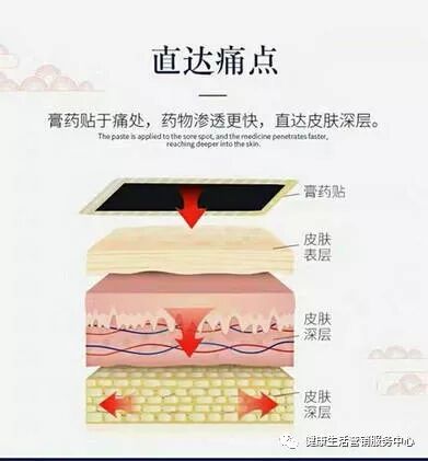 什么是冷敷理疗苗药骨神贴（黑膏静电理疗帖）_https://www.jmylbn.com_新闻资讯_第5张