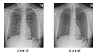 悬吊DR怎么安装学科建设 ‖ 放射科“再添利器”---我院引进DRX-Compass X悬吊结构DR系统_https://www.jmylbn.com_新闻资讯_第5张