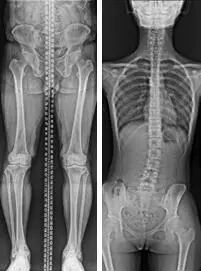 悬吊DR怎么安装学科建设 ‖ 放射科“再添利器”---我院引进DRX-Compass X悬吊结构DR系统_https://www.jmylbn.com_新闻资讯_第3张