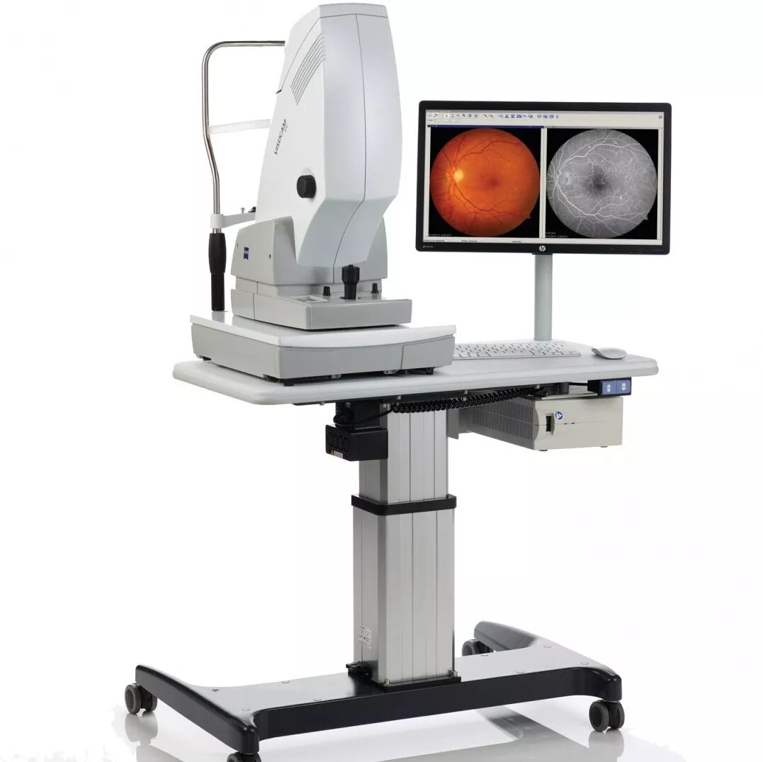 眼底激光机有什么牌子最近，兖矿新里程总医院眼科引进一系列国际先进诊疗利器_https://www.jmylbn.com_新闻资讯_第2张