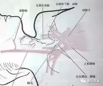 导丝怎么扩颈内静脉穿刺置管的临床经验_https://www.jmylbn.com_新闻资讯_第3张