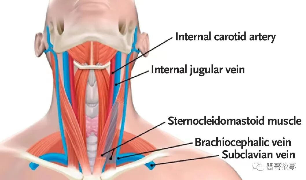 导丝怎么扩颈内静脉穿刺置管的临床经验_https://www.jmylbn.com_新闻资讯_第1张