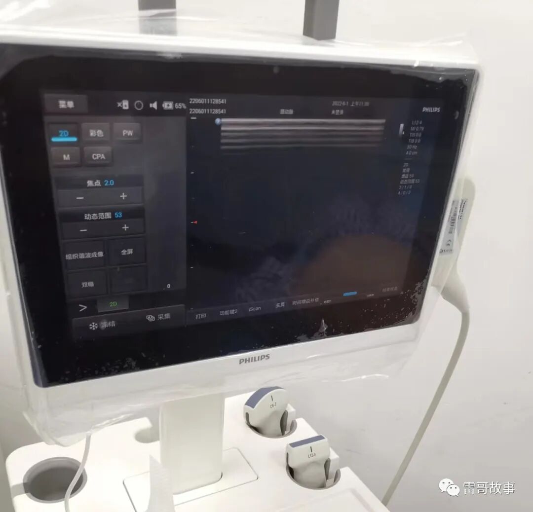 导丝怎么扩颈内静脉穿刺置管的临床经验_https://www.jmylbn.com_新闻资讯_第5张