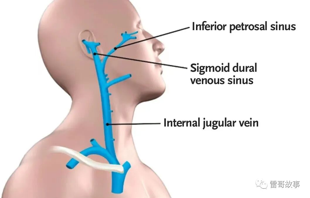 导丝怎么扩颈内静脉穿刺置管的临床经验_https://www.jmylbn.com_新闻资讯_第2张