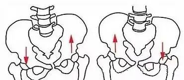 康复悬吊组装怎么装产后康复疗法 — 悬吊训练_https://www.jmylbn.com_新闻资讯_第7张