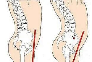 康复悬吊组装怎么装产后康复疗法 — 悬吊训练_https://www.jmylbn.com_新闻资讯_第6张