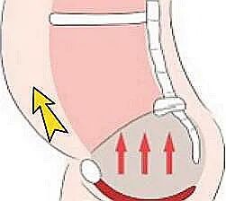 康复悬吊组装怎么装产后康复疗法 — 悬吊训练_https://www.jmylbn.com_新闻资讯_第14张