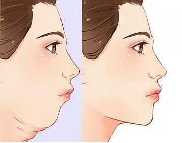 康复悬吊组装怎么装产后康复疗法 — 悬吊训练_https://www.jmylbn.com_新闻资讯_第13张