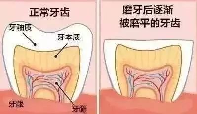 孩子夜裡磨牙，只是肚裡有蟲爬？真相真的不簡單！ 親子 第12張