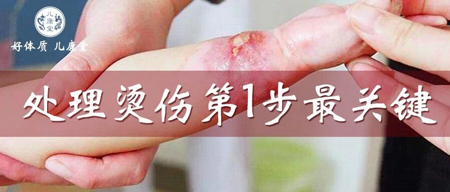 4岁娃烫伤，奶奶1个举动却害了他！这5字急救法，全家都要学会！