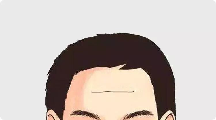 抬头纹暗藏玄机？