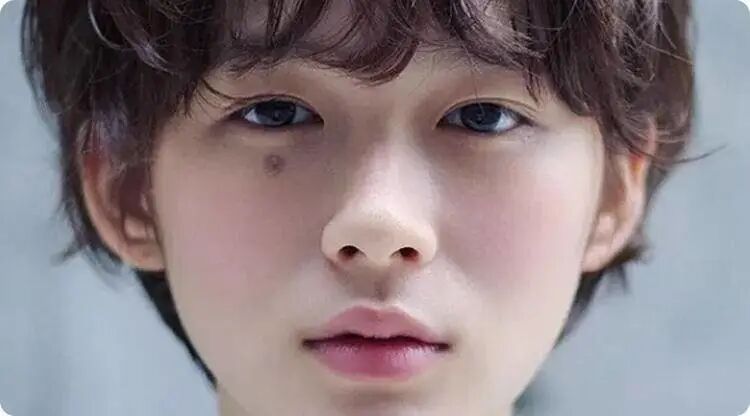 劳碌痣，越多命越苦，你身上有几颗？