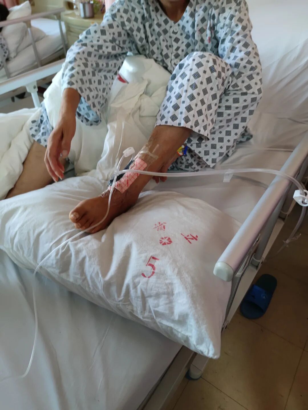 怎么促进vsd伤口愈合被虫子咬了一口，3年后伤口成8厘米巨大溃疡！_https://www.jmylbn.com_新闻资讯_第4张