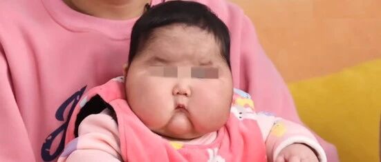 “大头娃娃”卷土重来！电商平台全面下架这两款宝宝霜！