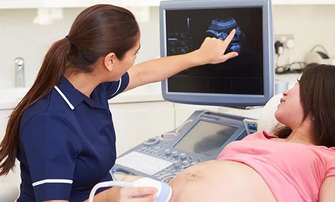 超声波诊断