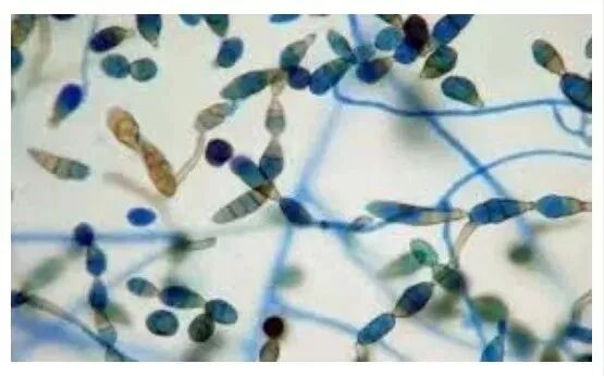 640?wx_fmt=jpeg&tp=webp&wxfrom=5&wx_lazy=1&wx_co=1