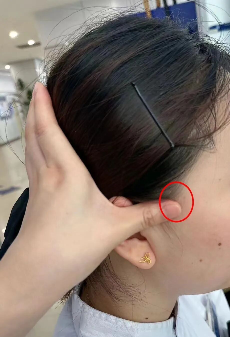 动脉什么压迫止血【健康科普】各部位指压止血方法，建议收藏_https://www.jmylbn.com_新闻资讯_第4张