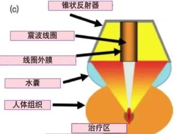 泰医医疗怎么样可优化微循环、避免严重或猝死事件发生：省泰医“体外心脏震波治疗中心”心血管再生疗法广受赞誉_https://www.jmylbn.com_新闻资讯_第6张