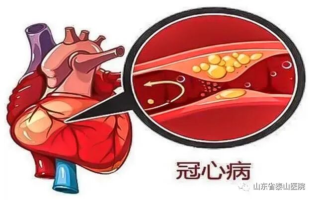 泰医医疗怎么样可优化微循环、避免严重或猝死事件发生：省泰医“体外心脏震波治疗中心”心血管再生疗法广受赞誉_https://www.jmylbn.com_新闻资讯_第8张