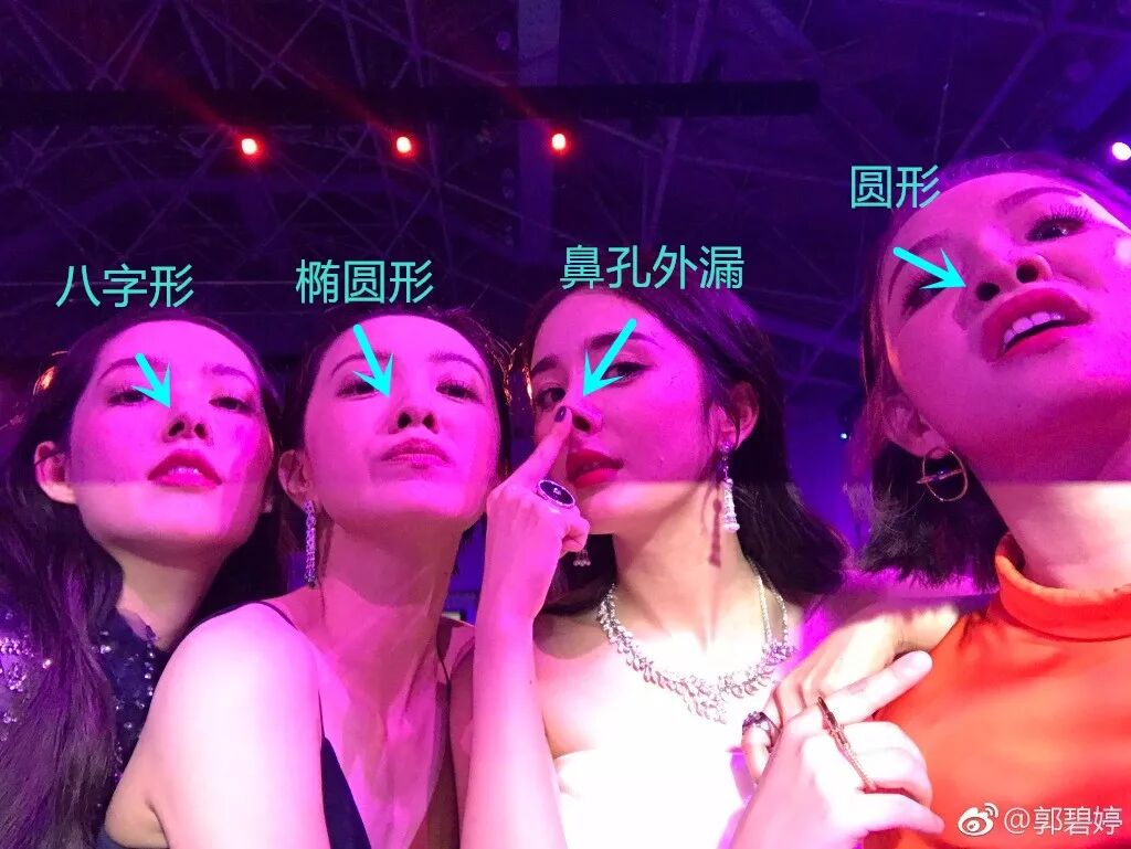 而且还有很多人存在鼻孔不对称,鼻孔外漏,鼻孔过大,鼻孔横卧等问题