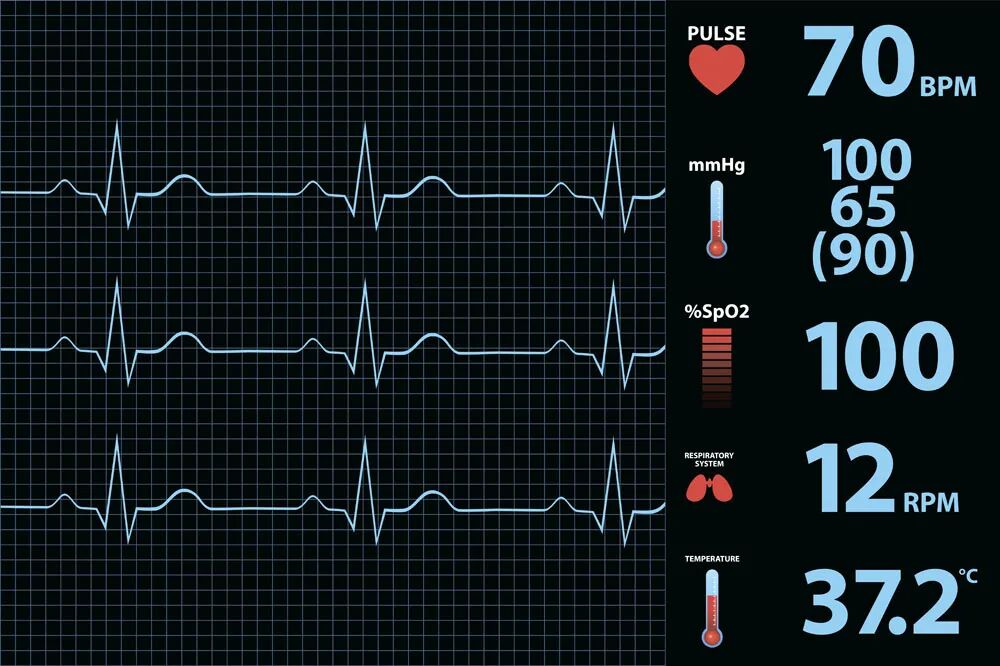 心电图12导怎么组成儿童心电图操作（常规12导联）_https://www.jmylbn.com_新闻资讯_第4张