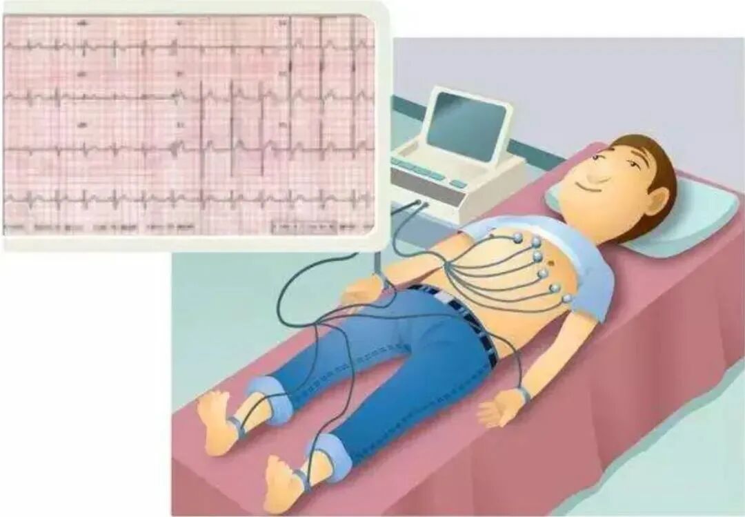 心电图12导怎么组成儿童心电图操作（常规12导联）_https://www.jmylbn.com_新闻资讯_第16张